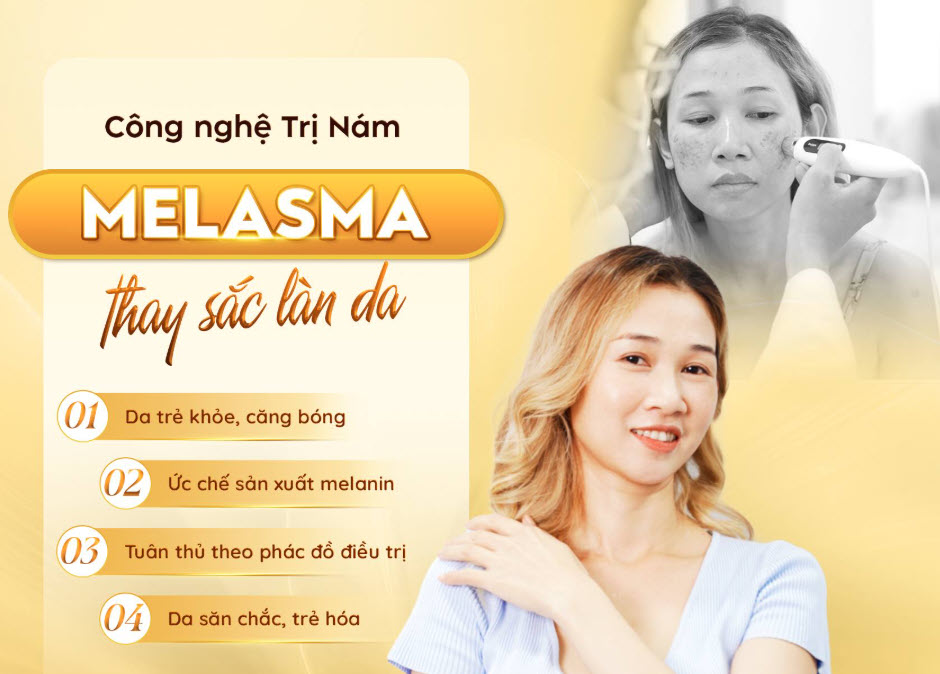 Trị nám, tàn nhang